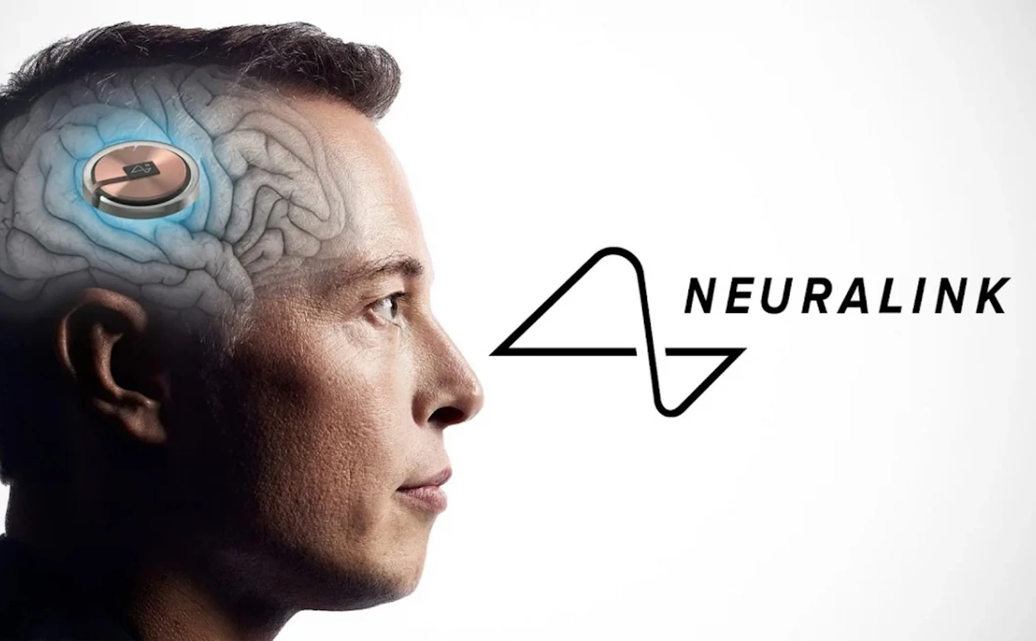 Dự án cấy ghép não của Elon Musk được chấp thuận thử nghiệm trên cơ thể người